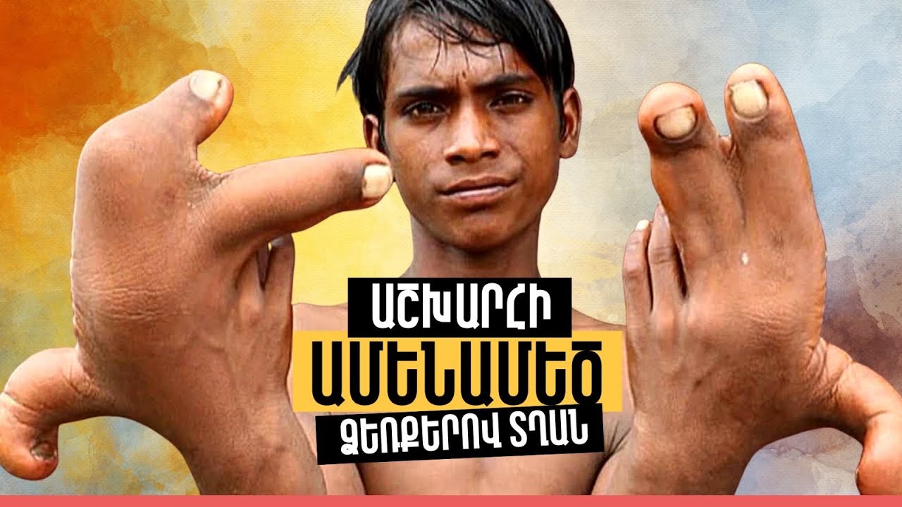 Իմ տղաներից ամենաաշխույժը Արմենն էր։